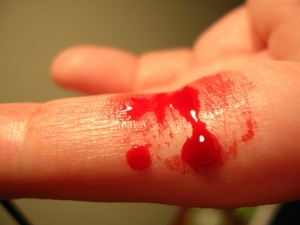 Bleeding_finger